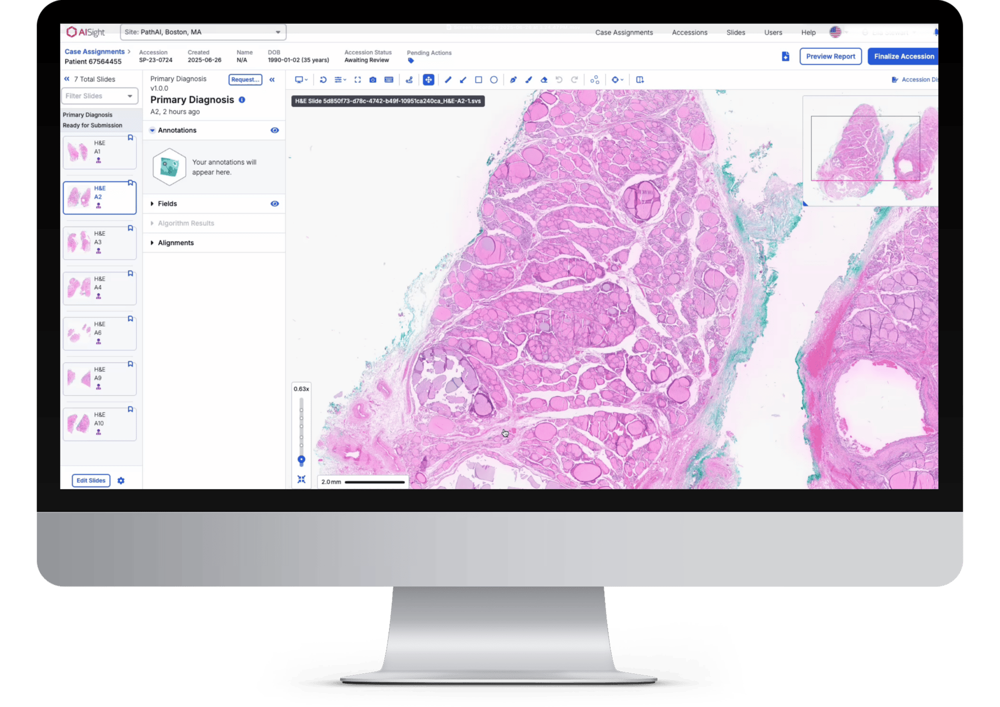 AISight Dx screenshot AISight Dx screenshot