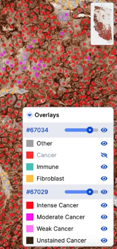 Oncology