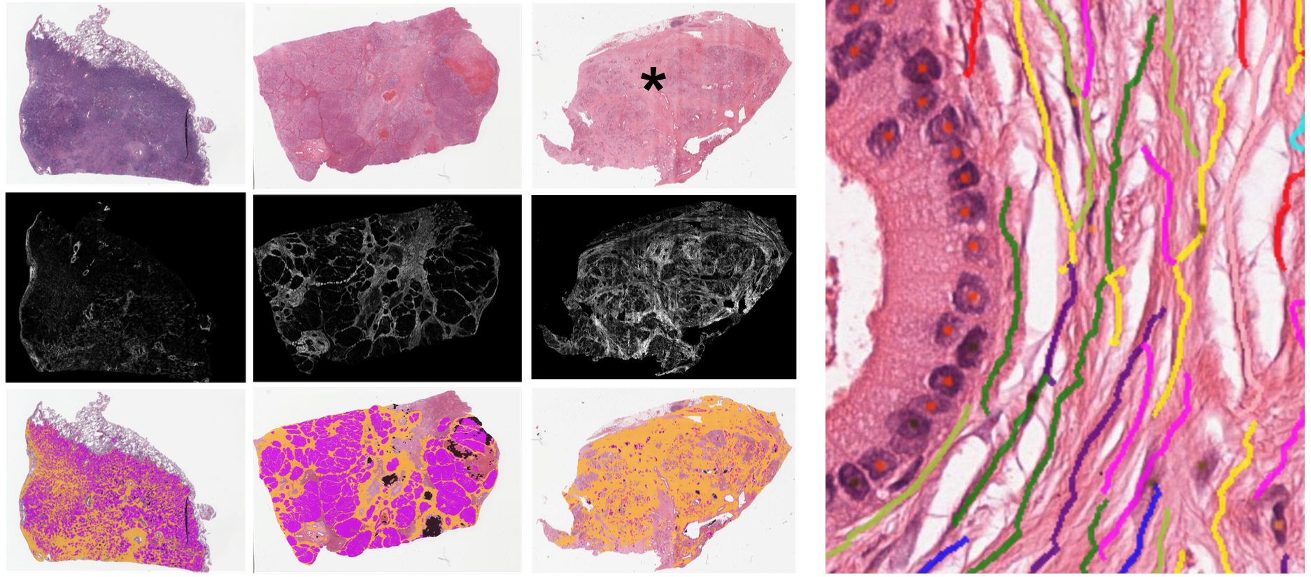 PathExplore Fibrosis
