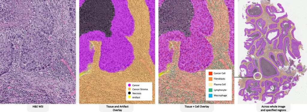auto-tissue-detection-1024x374-1